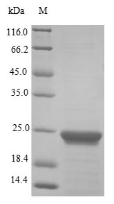 Human PPIA protein