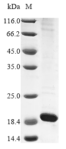 Bacteria BQ2027_MB3645C protein