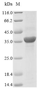 E. coli mrcB protein