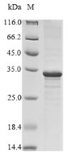 Virus M protein