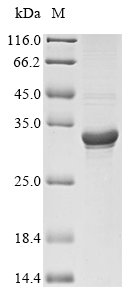 Insect Apium graveolens Major allergen Api g 1, isoallergen 2 protein