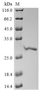 Plant Eisenia foetida Lysenin-related protein 2 protein
