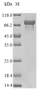 E. coli ppk protein