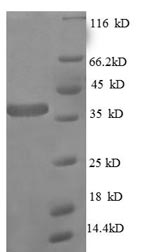 E. coli rpmA protein