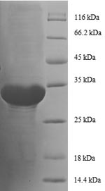 E. coli rpmC protein