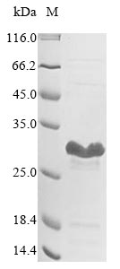 E. coli sspB protein
