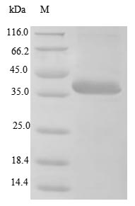 Virus BK polyomavirus Minor capsid protein VP2 protein