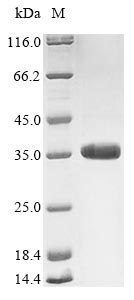 Virus A Outer capsid glycoprotein VP7 protein