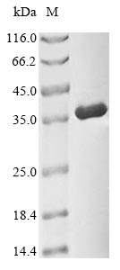 Human CDK1 protein