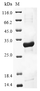 Virus GPC protein