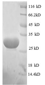 E. coli rpmG protein