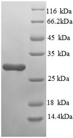 E. coli deoD protein