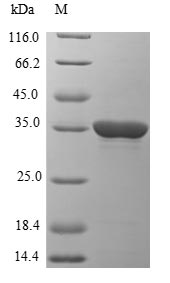 Virus EBNA1 protein