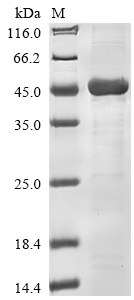 Virus Vespa mandarinia Vespakinin-M protein