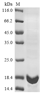 Human IGIP protein