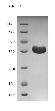 Virus A Outer capsid glycoprotein VP7 protein