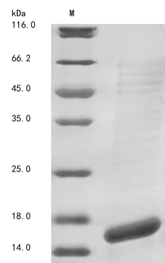 Human KCNMA1 protein
