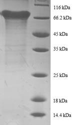 Human EIF4A2 protein