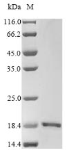 Human GRIN2A protein