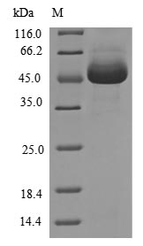 Human RIPK1 protein