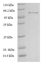 Human ARHGEF7 protein