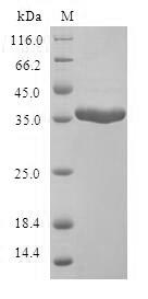 Human SCGB2A2 protein