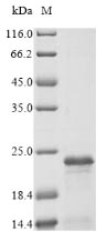 Human FXYD3 protein