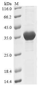 Human PKN1 protein