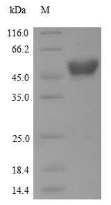 Human AANAT protein