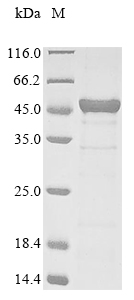 Human SMARCB1 protein