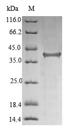Human HFE protein