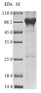 Human NAALADL2 protein