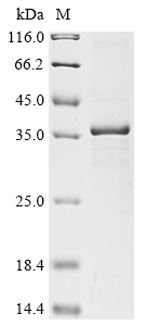 Rat Hsd17b13 protein