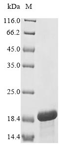 Human HEATR6 protein
