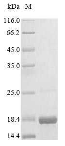 Human SH3PXD2A protein
