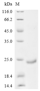Human ALKAL2 protein