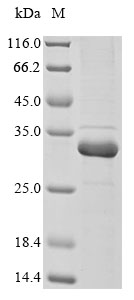 Animal Plasmodium falciparum Plasmepsin-2 protein