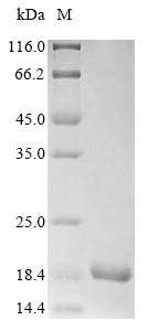 Fungi NCU05495 protein