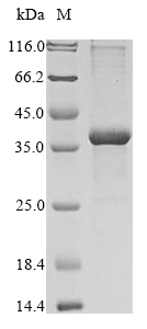 Human TTBK2 protein