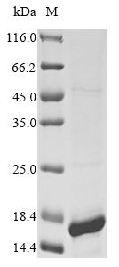 Insect Trypanosoma cruzi Cruzipain protein