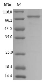 Human NRROS protein