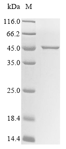 Virus metapneumovirus Phosphoprotein(P) protein