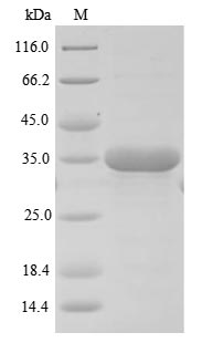 Mouse Susd4 protein
