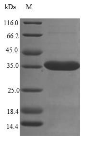 Mouse Susd4 protein