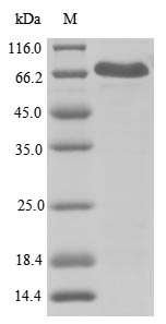 Human Cryopyrin protein