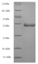 Animal Ctenocephalides felis Salivary antigen 1 protein