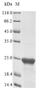 Human SREK1 protein