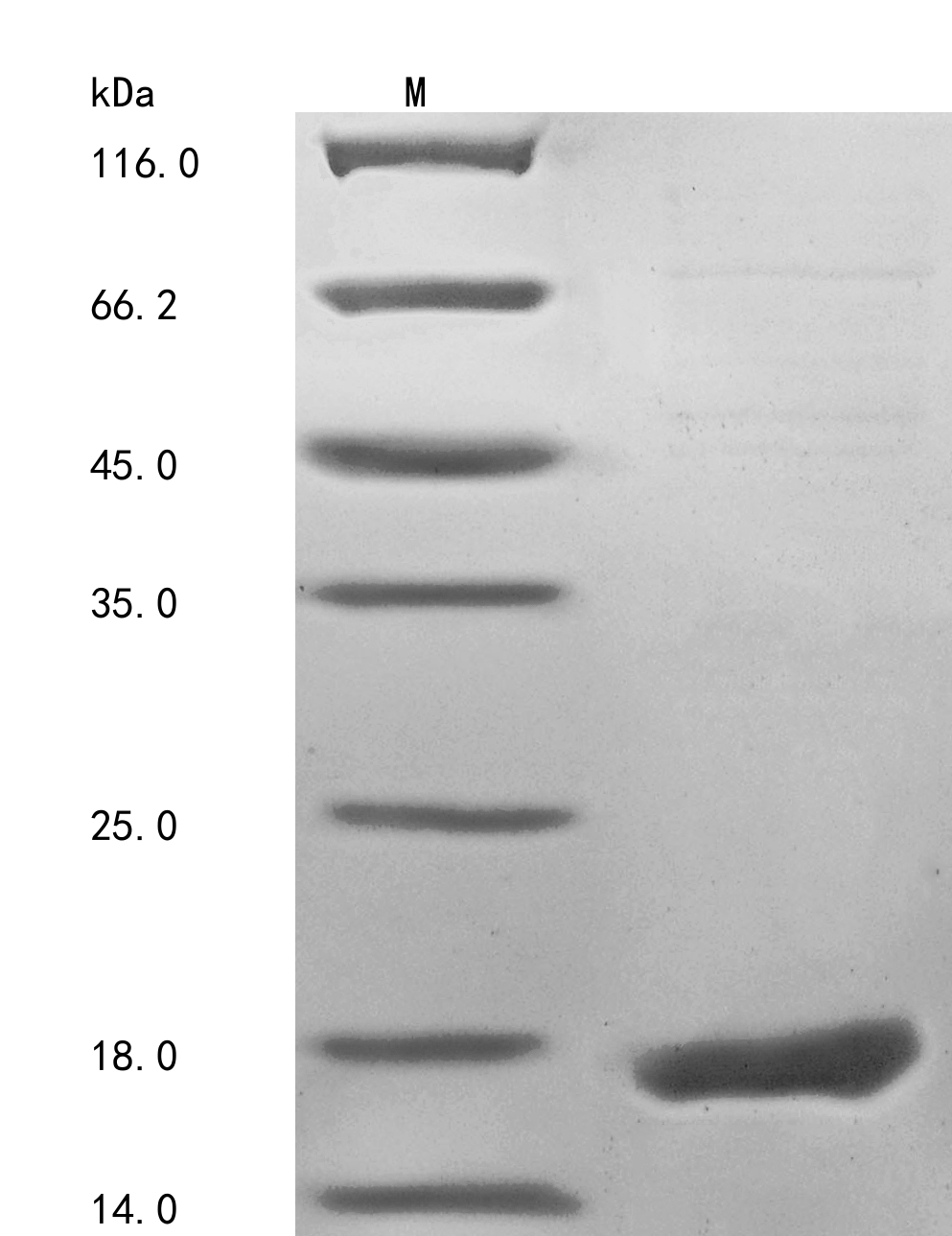 Human FMR1NB protein