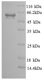 Human CANT1 protein