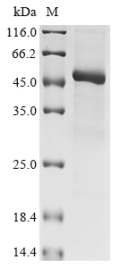 Human KLHDC3 protein